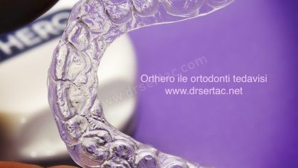 Orthero şeffafplak tedavisi ile ortodonti